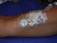 PICC Image 4 PICC Image 4
